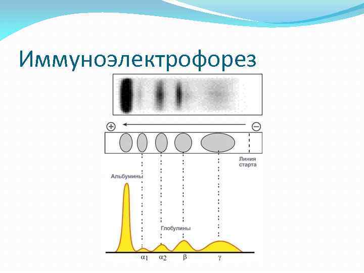 Иммуноэлектрофорез 