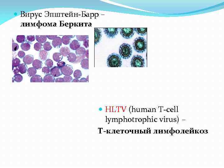 Презентация на тему лимфома