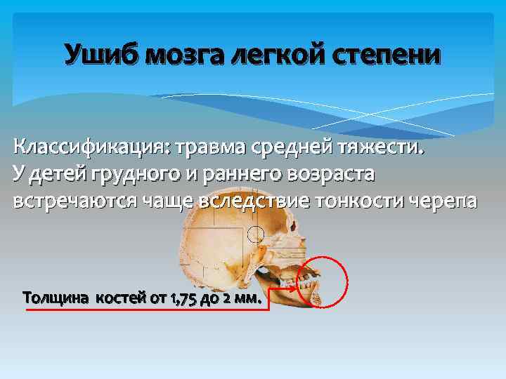 Ушиб мозга легкой степени Классификация: травма средней тяжести. У детей грудного и раннего возраста