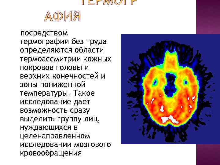 посредством термографии без труда определяются области термоассмитрии кожных покровов головы и верхних конечностей и