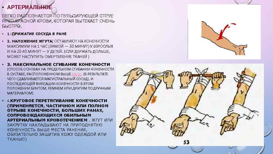  • АРТЕРИАЛЬНОЕ ЛЕГКО РАСПОЗНАЕТСЯ ПО ПУЛЬСИРУЮЩЕЙ СТРУЕ ЯРКО-КРАСНОЙ КРОВИ, КОТОРАЯ ВЫТЕКАЕТ ОЧЕНЬ БЫСТРО.