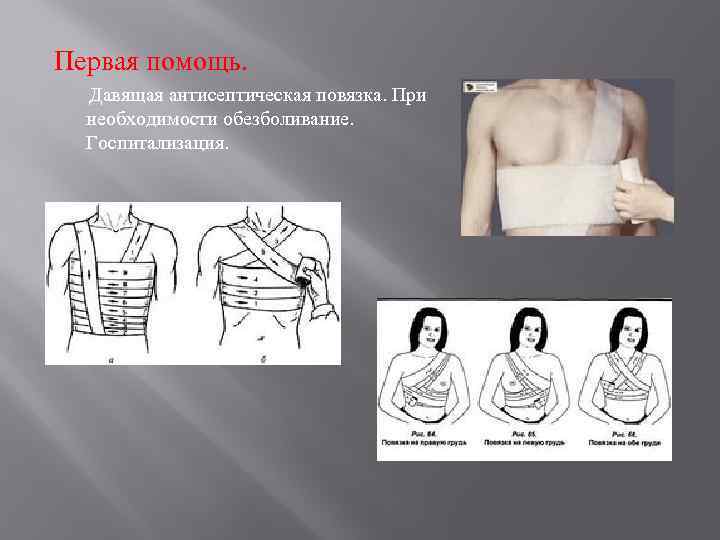 Первая помощь. Давящая антисептическая повязка. При необходимости обезболивание. Госпитализация. 