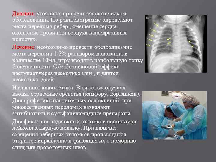 Диагноз: уточняют при рентгенологическом обследовании. По рентгенограмме определяют места перелома ребер , смещение сердца,