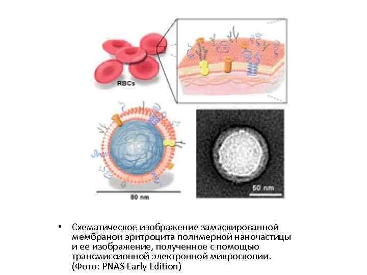  • Схематическое изображение замаскированной мембраной эритроцита полимерной наночастицы и ее изображение, полученное с