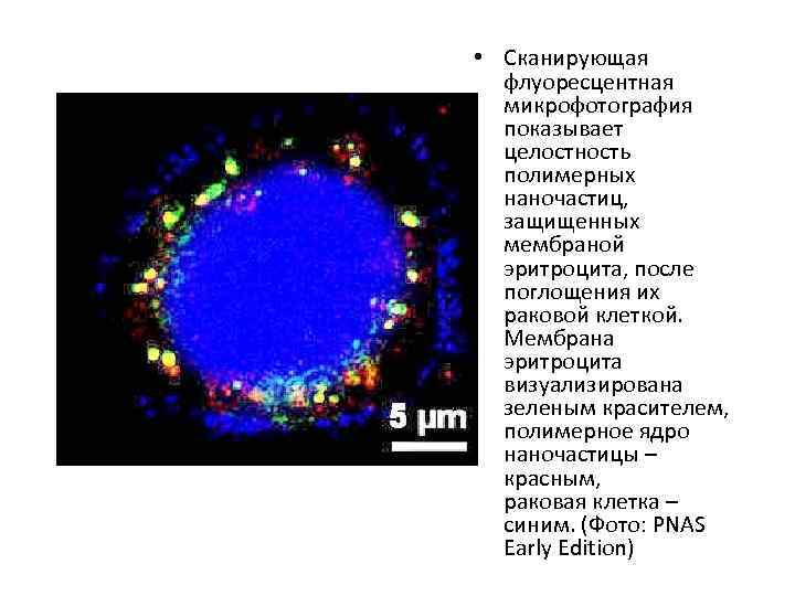  • Сканирующая флуоресцентная микрофотография показывает целостность полимерных наночастиц, защищенных мембраной эритроцита, после поглощения