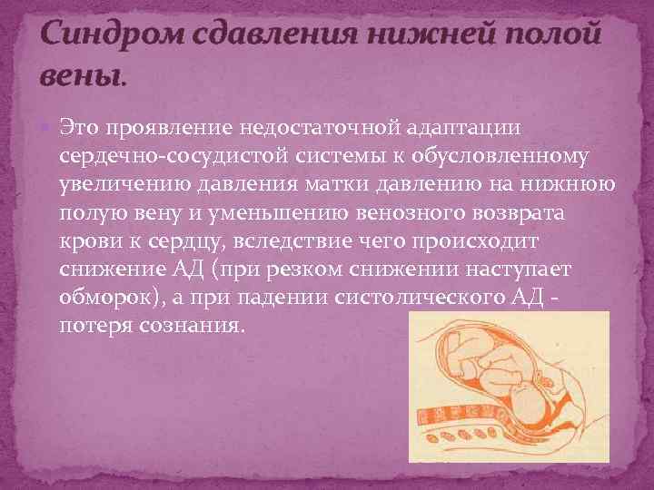 Синдром сдавления нижней полой вены. Это проявление недостаточной адаптации сердечно-сосудистой системы к обусловленному увеличению