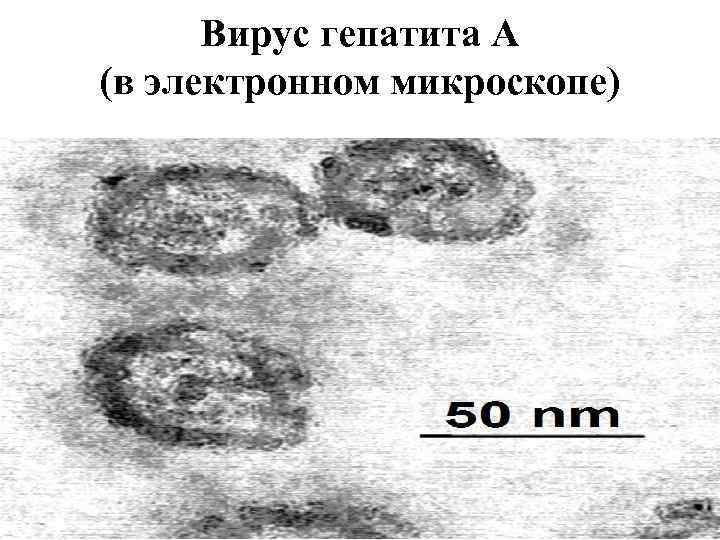 Вирус гепатита А (в электронном микроскопе) 