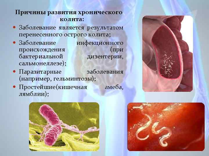 Причины развития хронического колита: Заболевание является результатом перенесенного острого колита; Заболевание инфекционного происхождения (при