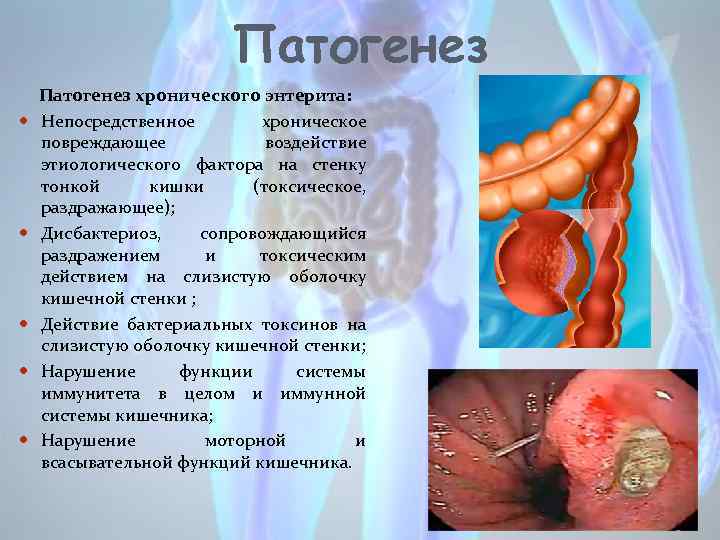 Патогенез Патогенез хронического энтерита: Непосредственное хроническое повреждающее воздействие этиологического фактора на стенку тонкой кишки