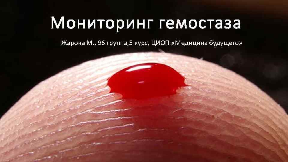 Мониторинг гемостаза Жарова М. , 96 группа, 5 курс, ЦИОП «Медицина будущего» 