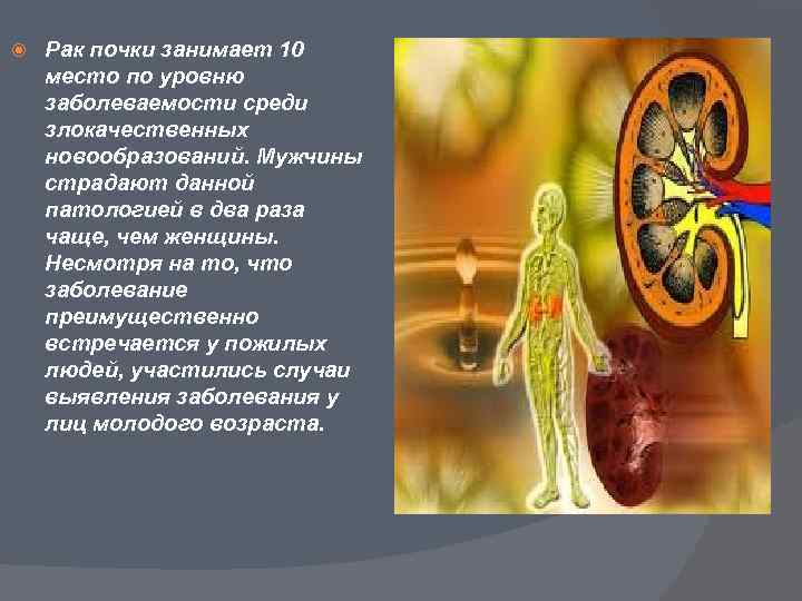  Рак почки занимает 10 место по уровню заболеваемости среди злокачественных новообразований. Мужчины страдают