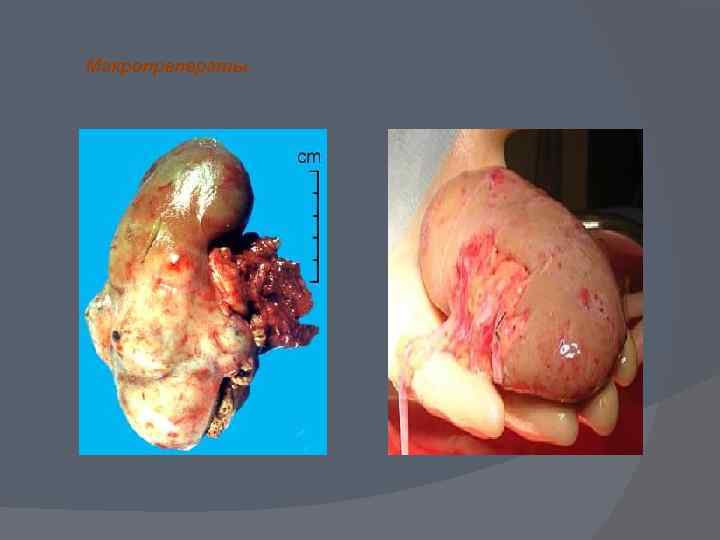 Макропреператы 