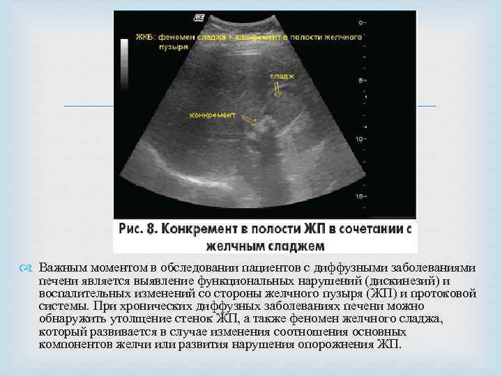  Важным моментом в обследовании пациентов с диффузными заболеваниями печени является выявление функциональных нарушений