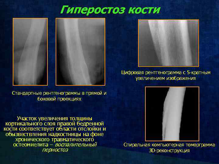 Единица цифрового изображения на рентгенограмме это