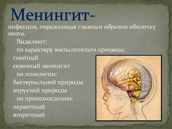 Менингит- инфекция, поражающая главным образом оболочку мозга. Выделяют: по характеру воспалительго процесса: - гнойный