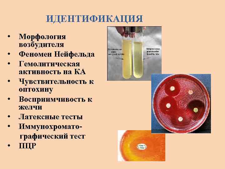 ИДЕНТИФИКАЦИЯ • • Морфология возбудителя Феномен Нейфельда Гемолитическая активность на КА Чувствительность к оптохину