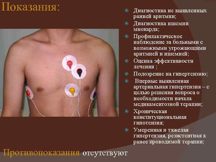 Показания: Противопоказания отсутствуют Диагностика не выявленных ранней аритмии; Диагностика ишемии миокарда; Профилактическое наблюдение за