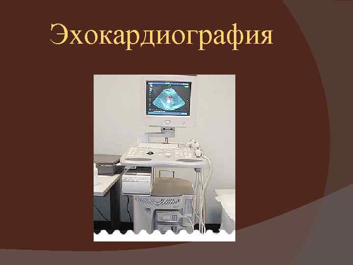 Эхокардиография 
