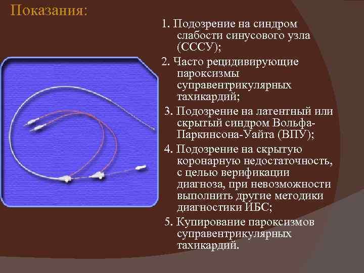 Показания: 1. Подозрение на синдром слабости синусового узла (СССУ); 2. Часто рецидивирующие пароксизмы суправентрикулярных