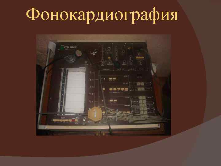 Фонокардиография 