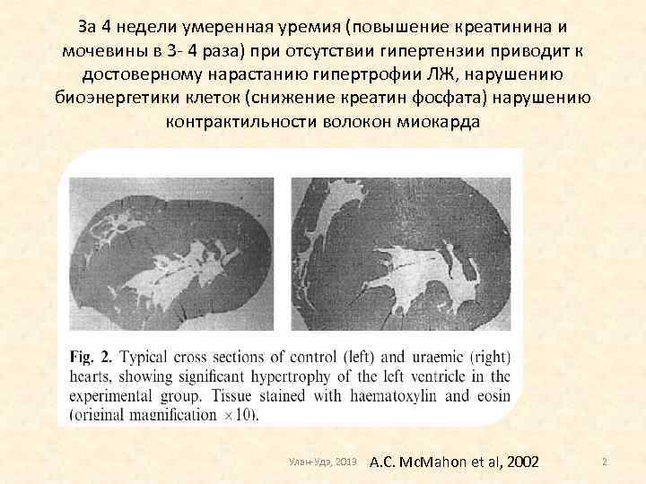 За 4 недели умеренная уремия (повышение креатинина и мочевины в 3 - 4 раза)