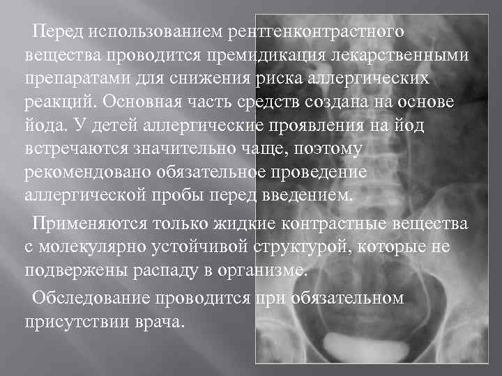 Перед использованием рентгенконтрастного вещества проводится премидикация лекарственными препаратами для снижения риска аллергических реакций. Основная