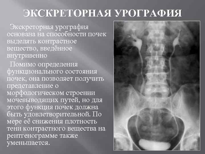 ЭКСКРЕТОРНАЯ УРОГРАФИЯ Экскреторная урография основана на способности почек выделять контрастное вещество, введённое внутривенно Помимо