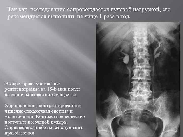 Так как исследование сопровождается лучевой нагрузкой, его рекомендуется выполнять не чаще 1 раза в