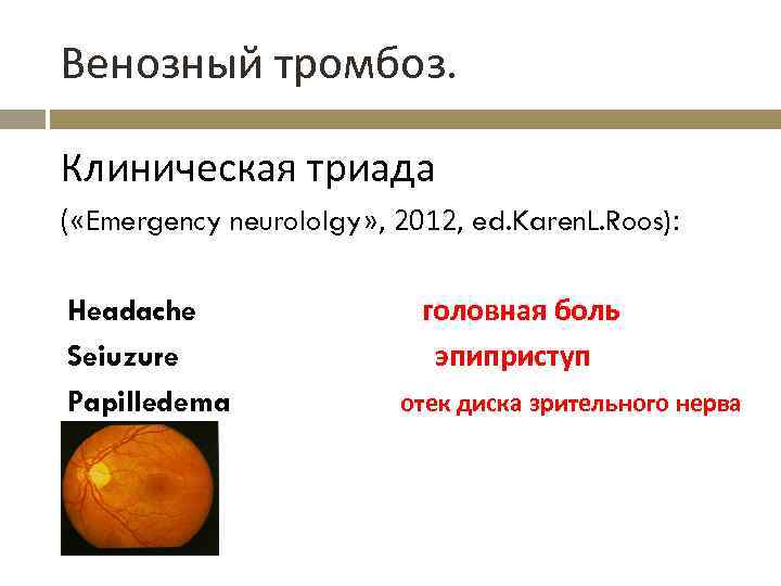 Венозный тромбоз. Клиническая триада ( «Emergency neurololgy» , 2012, ed. Karen. L. Roos): Headache