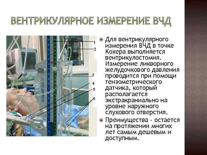  Для вентрикулярного измерения ВЧД в точке Kохера выполняется вентрикулостомия. Измерение ликворного желудочкового давления