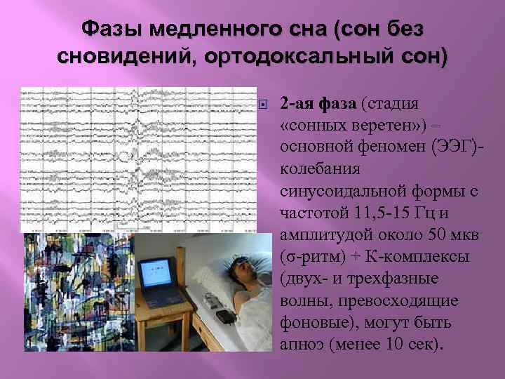 Фазы медленного сна (сон без сновидений, ортодоксальный сон) 2 -ая фаза (стадия «сонных веретен»