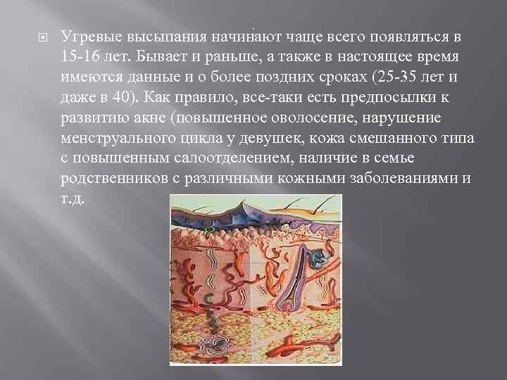 . Угревые высыпания начинают чаще всего появляться в 15 -16 лет. Бывает и раньше,