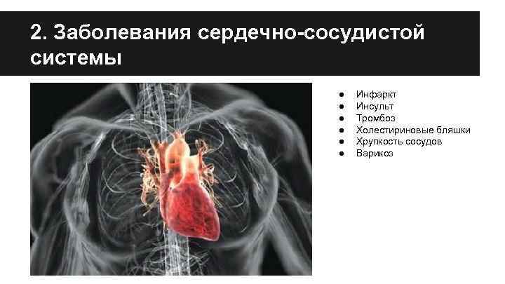 2. Заболевания сердечно-сосудистой системы ● ● ● Инфаркт Инсульт Тромбоз Холестириновые бляшки Хрупкость сосудов