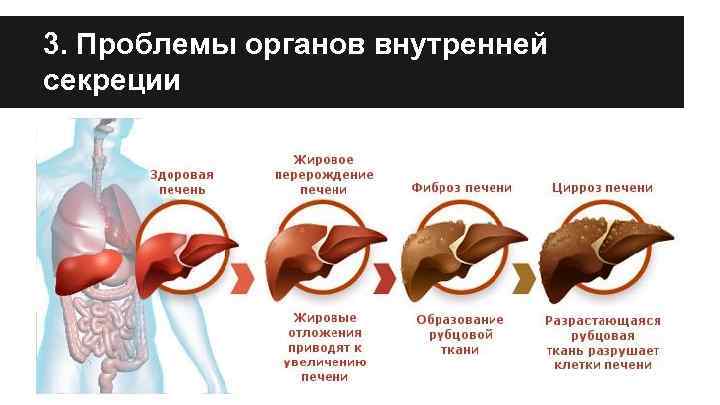 3. Проблемы органов внутренней секреции 