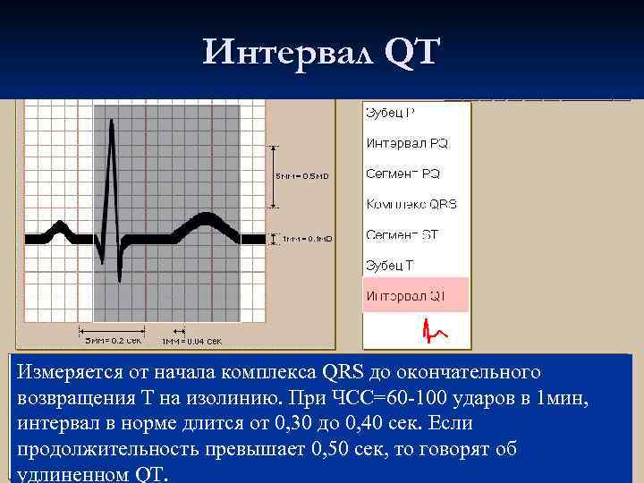 Интервал QT Измеряется от начала комплекса QRS до окончательного возвращения Т на изолинию. При