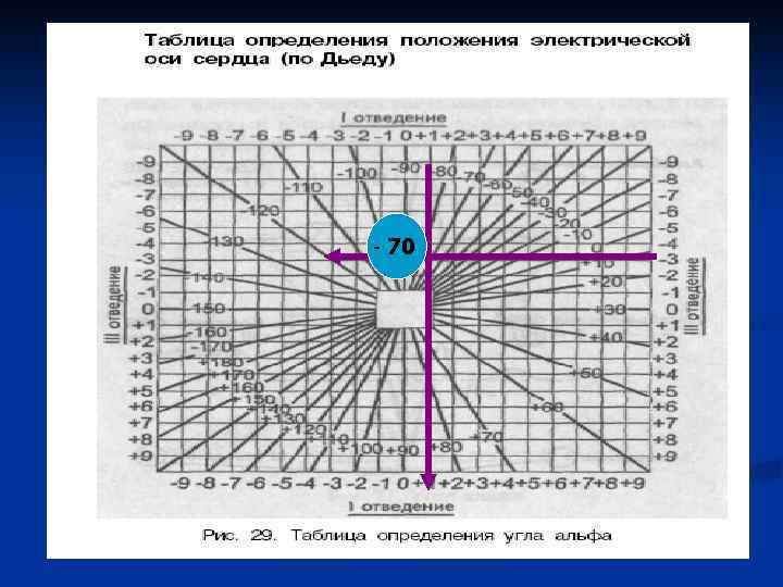 Диаграмма дьеда экг