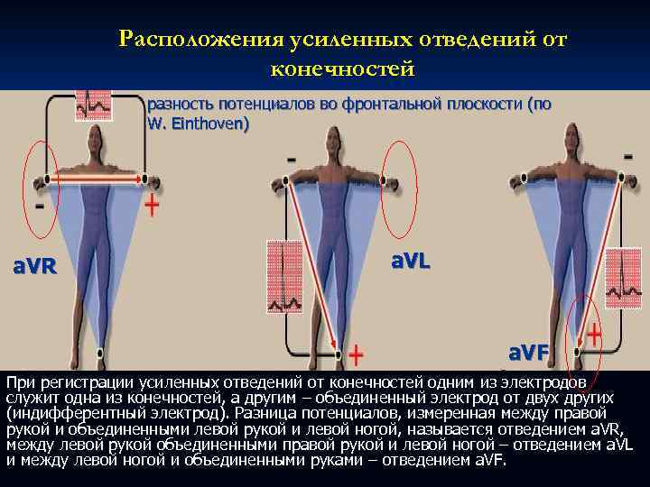 Расположения усиленных отведений от конечностей разность потенциалов во фронтальной плоскости (по W. Einthoven) a.