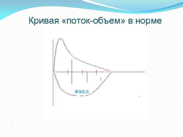 Кривая «поток-объем» в норме ПЕФ МОС 25 МОС 50 МОС 7 5 ФЖЕЛ 