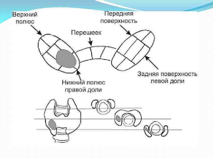 Схема щитовидной железы по узи