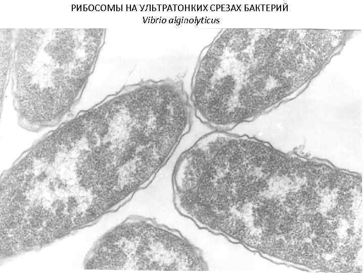 РИБОСОМЫ НА УЛЬТРАТОНКИХ СРЕЗАХ БАКТЕРИЙ Vibrio alginolyticus 