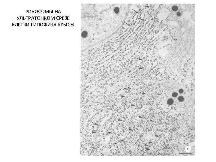 РИБОСОМЫ НА УЛЬТРАТОНКОМ СРЕЗЕ КЛЕТКИ ГИПОФИЗА КРЫСЫ 