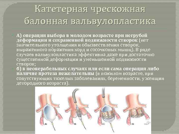 Транслюминальная хирургия презентация