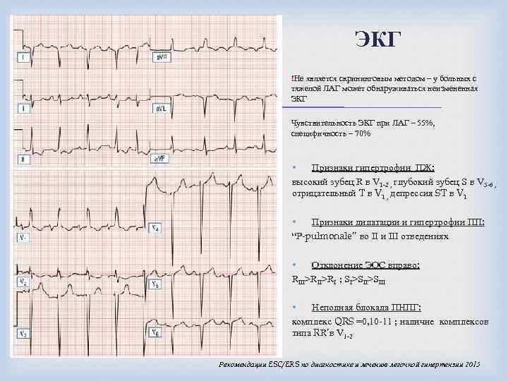 ЭКГ !Не является скрининговым методом – у больных с тяжелой ЛАГ может обнаруживаться неизмененная
