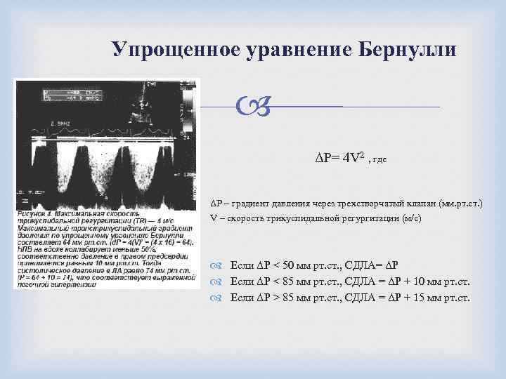 Упрощенное уравнение Бернулли ΔР= 4 V 2 , где ΔР – градиент давления через