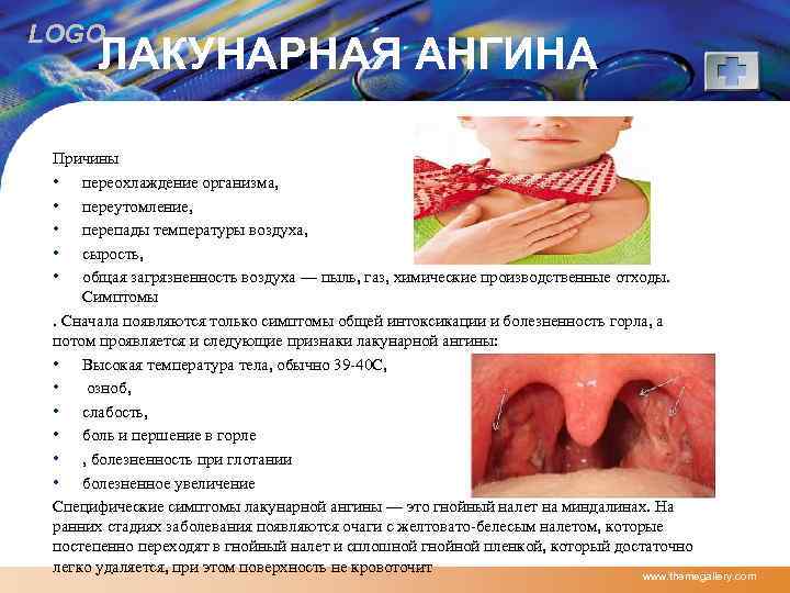 LOGO ЛАКУНАРНАЯ АНГИНА Причины • переохлаждение организма, • переутомление, • перепады температуры воздуха, •