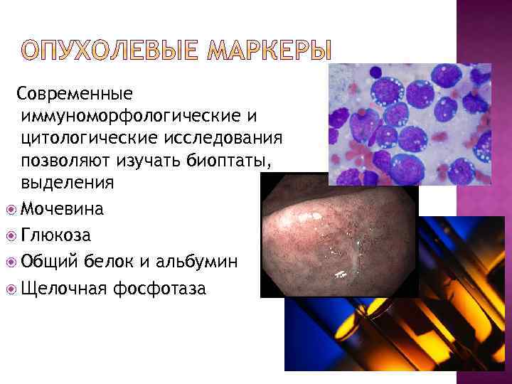 Современные иммуноморфологические и цитологические исследования позволяют изучать биоптаты, выделения Мочевина Глюкоза Общий белок и