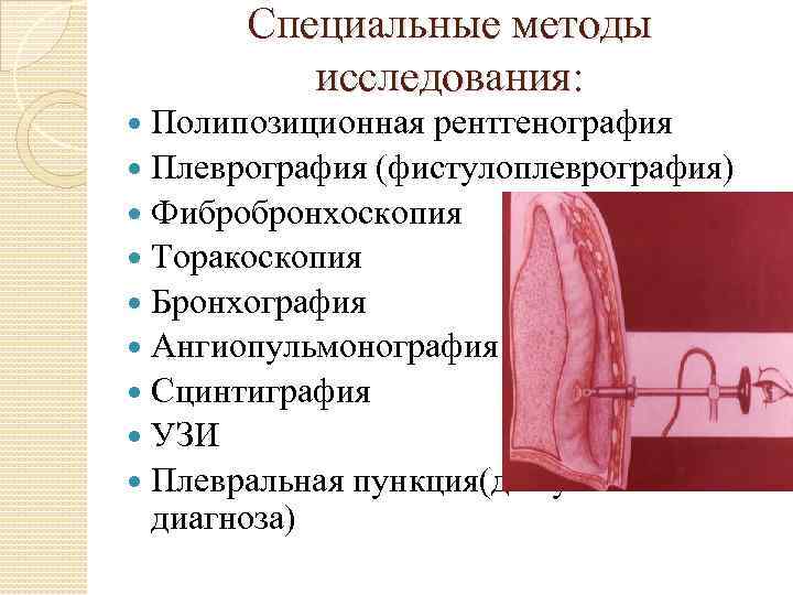 Специальные методы исследования: Полипозиционная рентгенография Плеврография (фистулоплеврография) Фибробронхоскопия Торакоскопия Бронхография Ангиопульмонография Сцинтиграфия УЗИ Плевральная