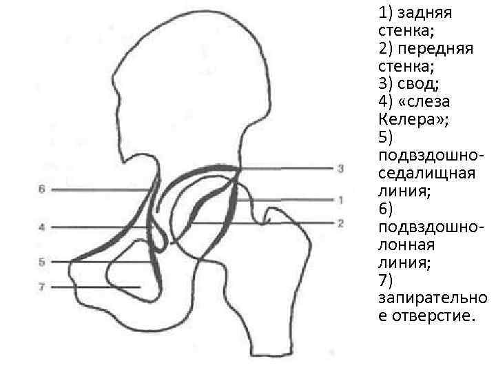  • 1) задняя стенка; 2) передняя стенка; 3) свод; 4) «слеза Келера» ;