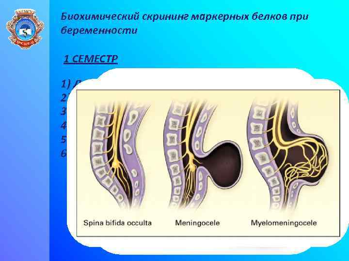 Биохимический скрининг маркерных белков при беременности 1 СЕМЕСТР 1) Дефект нервной трубки 2) Дефект