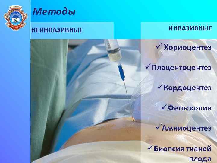 Методы НЕИНВАЗИВНЫЕ ü Хориоцентез ü УЗИ üЦветное доплеровское картирование üКардиотокография üДоплерография üПлацентоцентез üКордоцентез üФетоскопия